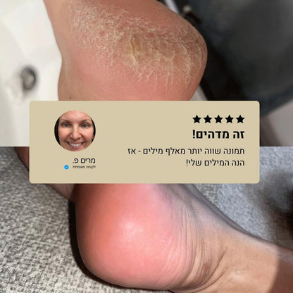 PuraDerma™ - ערכת טיפול קלינית לרגליים